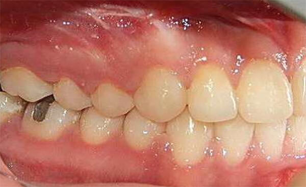 Fig. 20 Derecha