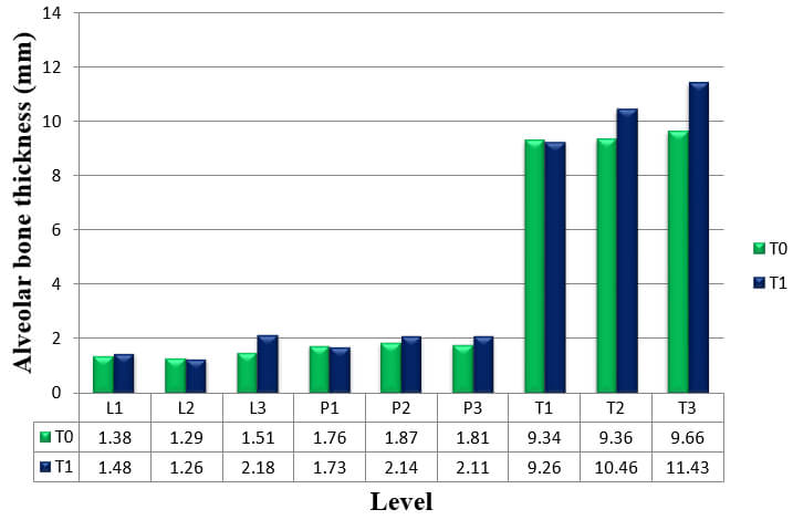 Graph 4: Alveolar bone thickness of upper right canine at T0 and T2 measurements