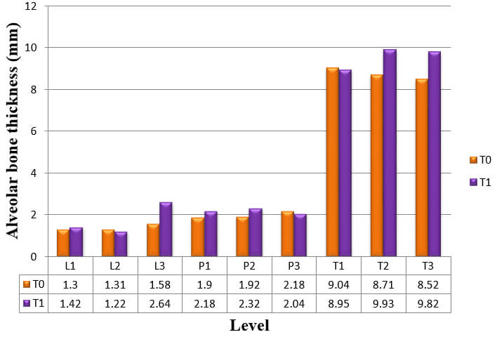 Graph 5: Alveolar bone thickness of upper right lateral incisor at T0 and T2 measurements