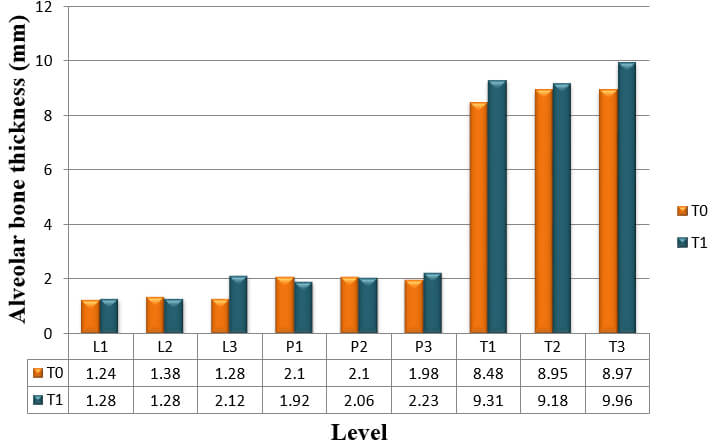 Graph 6: Alveolar bone thickness of upper right central incisor at T0 and T2 measurements