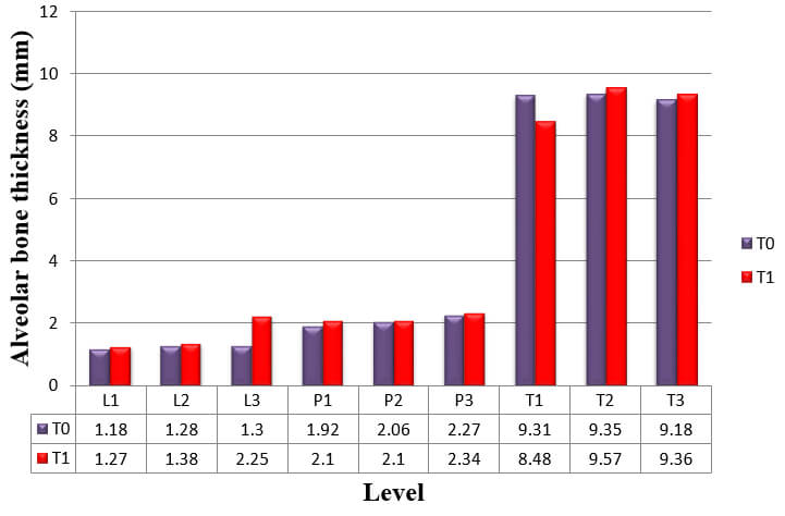 Graph 7: Alveolar bone thickness of upper left central incisor at T0 and T2 measurements