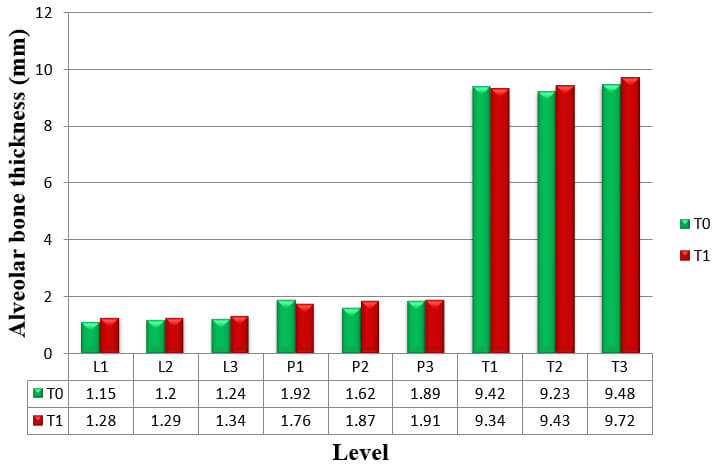 Graph 9: Alveolar bone thickness of upper left canine at T0 and T2 measurements