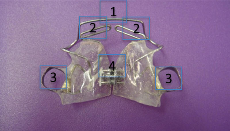 Figure 1. Parts that conform Ponce’s Modified Orthopedic Device Source: own