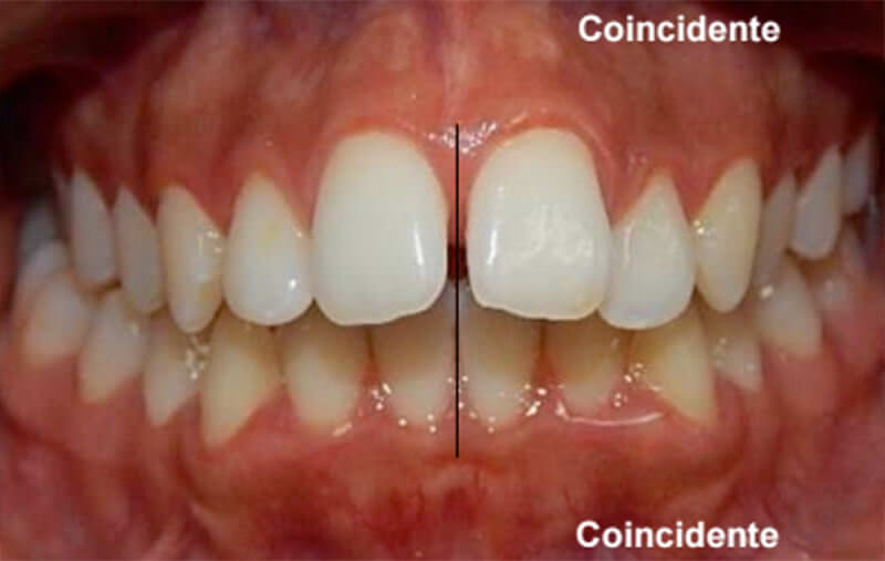 Fig. 4 Intraoral de frente