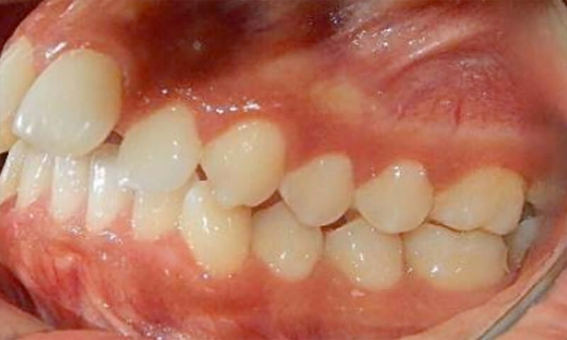 Fig. 6 Izquierda inicio