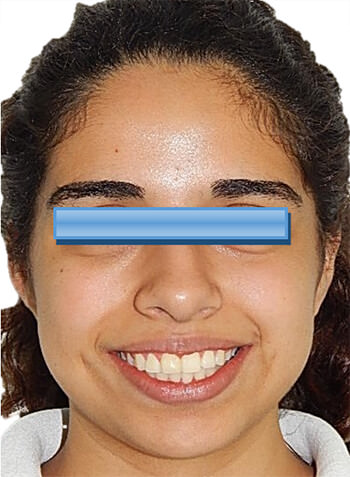 Fig. 10. Sonrisa
