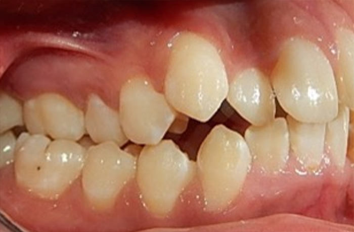 Fig. 3 Intraoral derecha