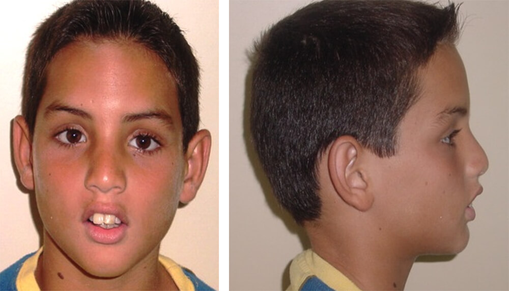 Foto de frente / Foto de perfil