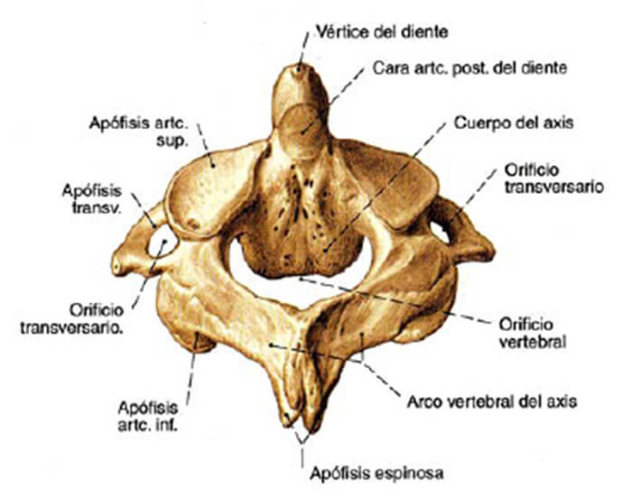 Fig 3. SEGUNDA VERTEBRA CERVICAL