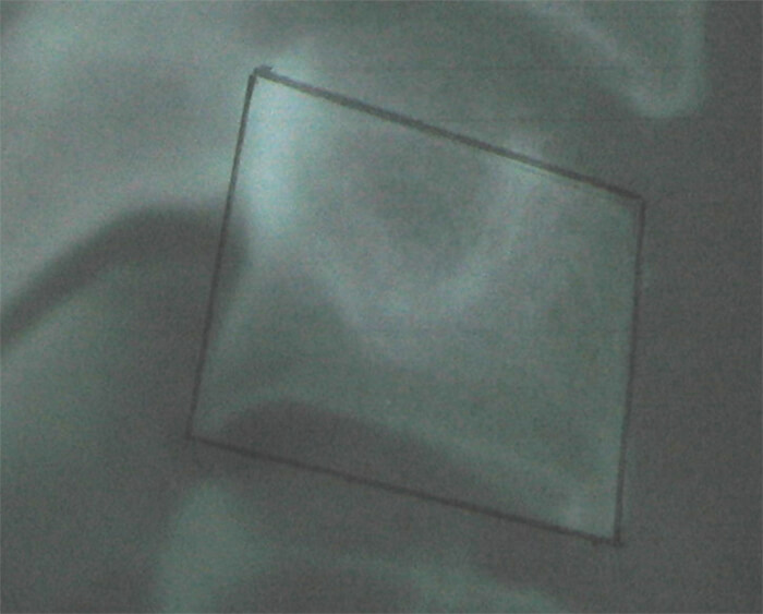 Fig 12. FORMA CUADRADA