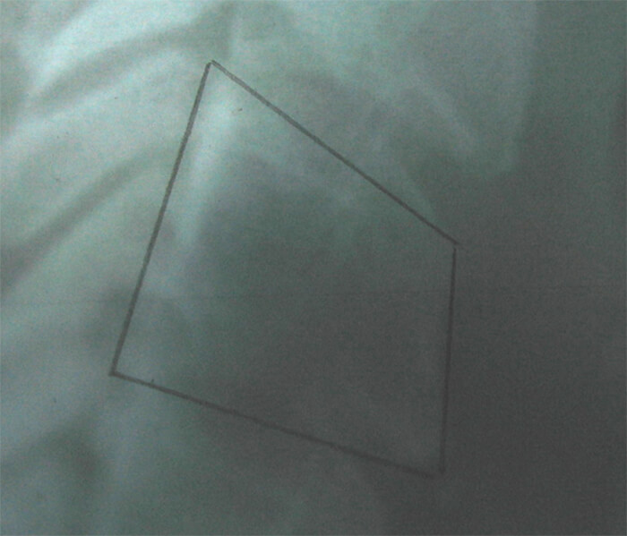 Fig 13. FORMA RECTANGULAR VERTICAL