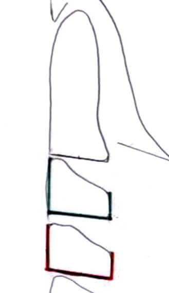 Fig 18. MEDICIÓN DE LA FORMA