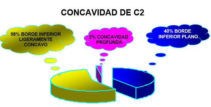 GRAFICO 3 Distribución de la frecuencia de la concavidad de la segunda vértebra cervical