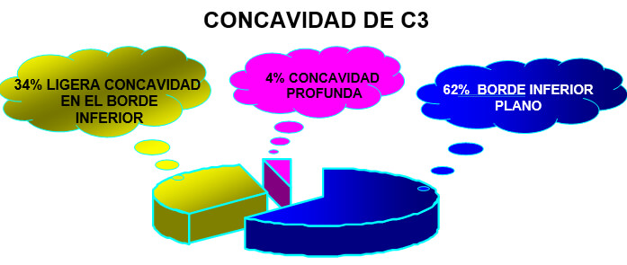 GRAFICO 4 Distribución de la frecuencia de la concavidad de la tercera vértebra cervical