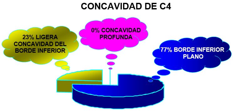 GRAFICO 5 Distribución de la frecuencia de la concavidad de la cuarta vértebra cervical