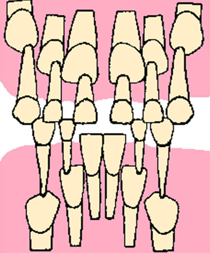 FIGURA 8 Dibujo esquemático de las características radiográficas observadas por Van der Linden en la zona anteroinferior de un paciente con patrón de erupción normal.