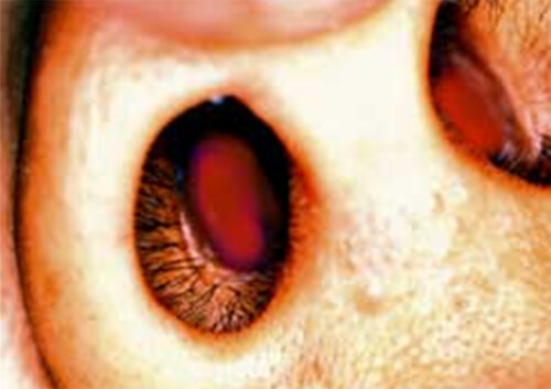 Figura Nº 2