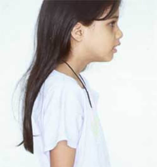 Figura Nº 3