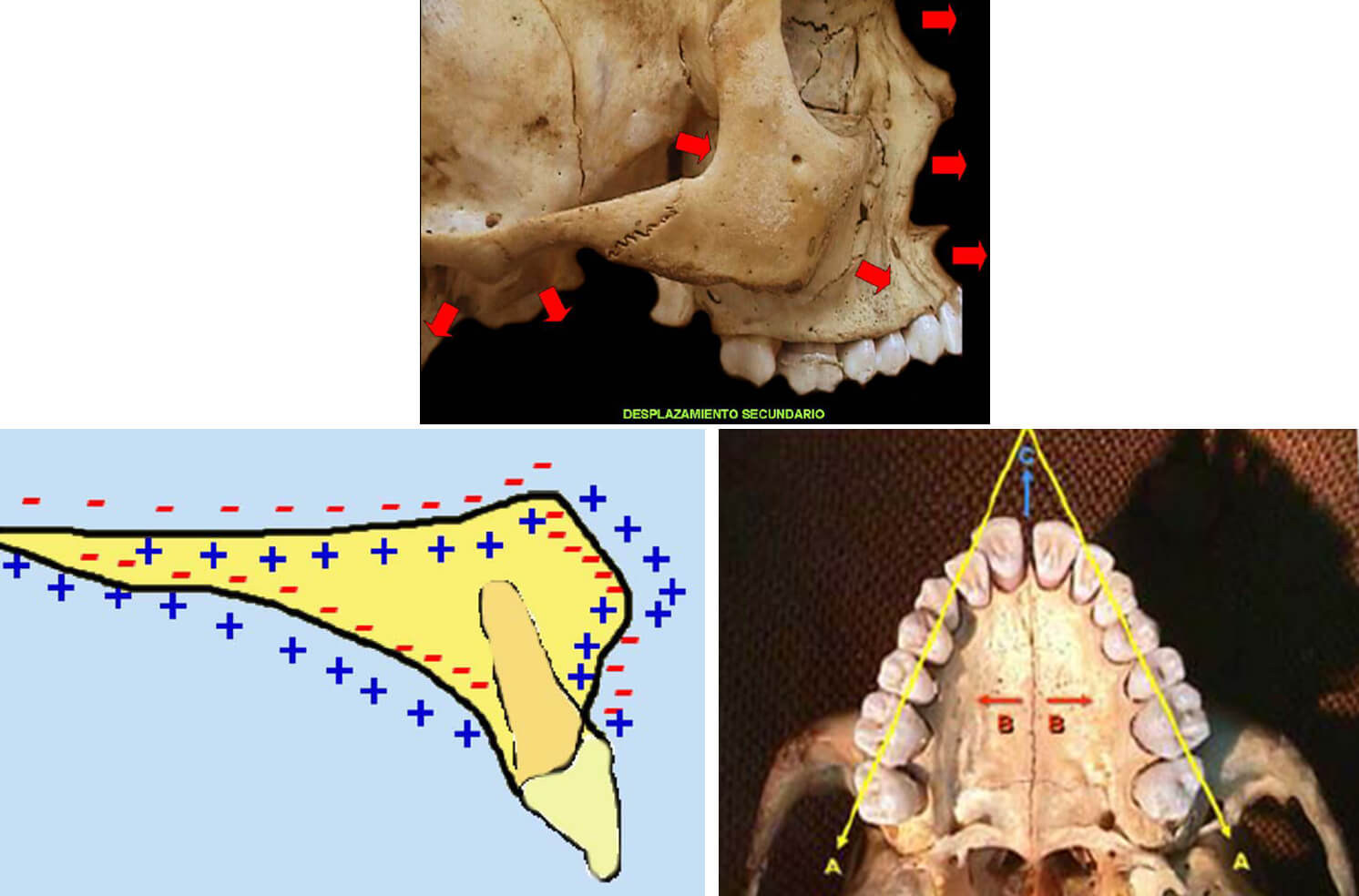 Figuras 1a, 1b, 1c Crecimiento Naso-Máxilo-Facial (Fuente: Compendio de Crecimiento y Desarrollo Craneofacial)(10)