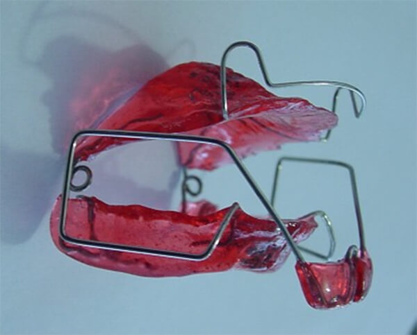 Figura 14d Posicionador Mandibular Activo Quirós Crespo (Fuente: propia)