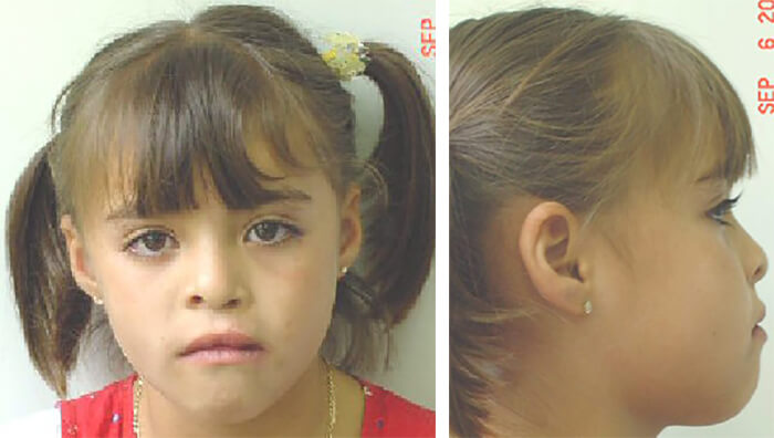 Fig. 1 y 2