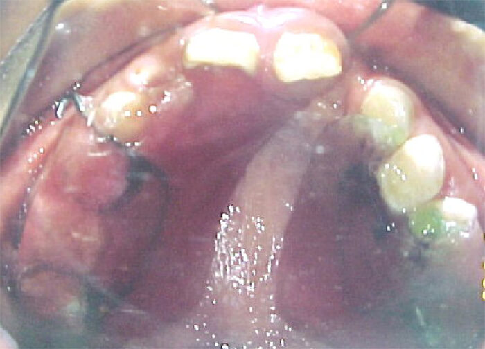 Fig. 6