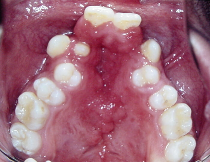 Fig. 2 Fuente propia CESO