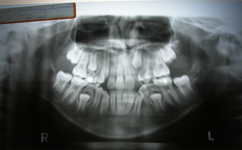 Figura 5