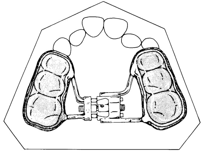Figura 4