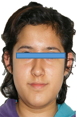 Fig. 1 Frente de inicio