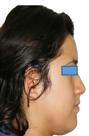 Fig. 2 Perfil de inicio