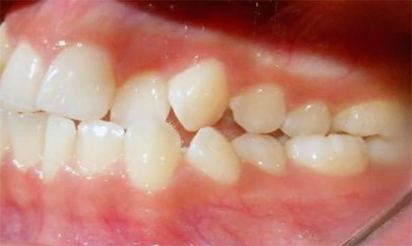 Fig. 6 Lateral izquierda