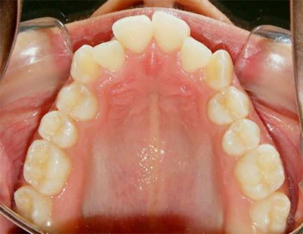 Fig. 7 Oclusal superior