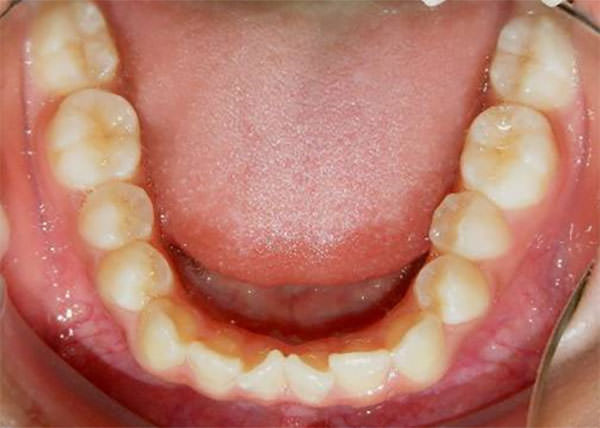 Fig. 8 Oclusal inferior