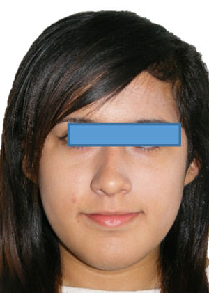 Fig. 11 Frente progreso