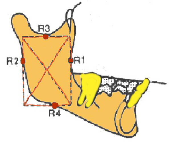 Figura 1