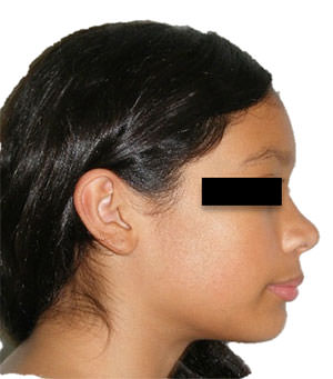 Fig. 2 Perfil