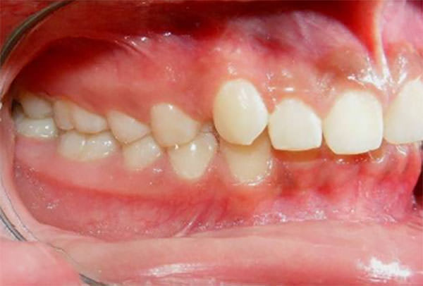 Fig. 4 Lateral derecha