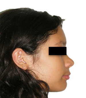 Fig. 9 Perfil