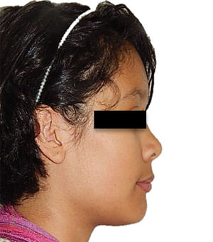 Fig. 11 Perfil final