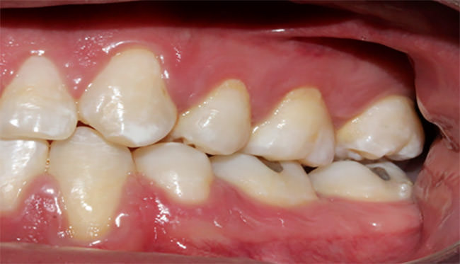 Fig.16 Lateral izquierda