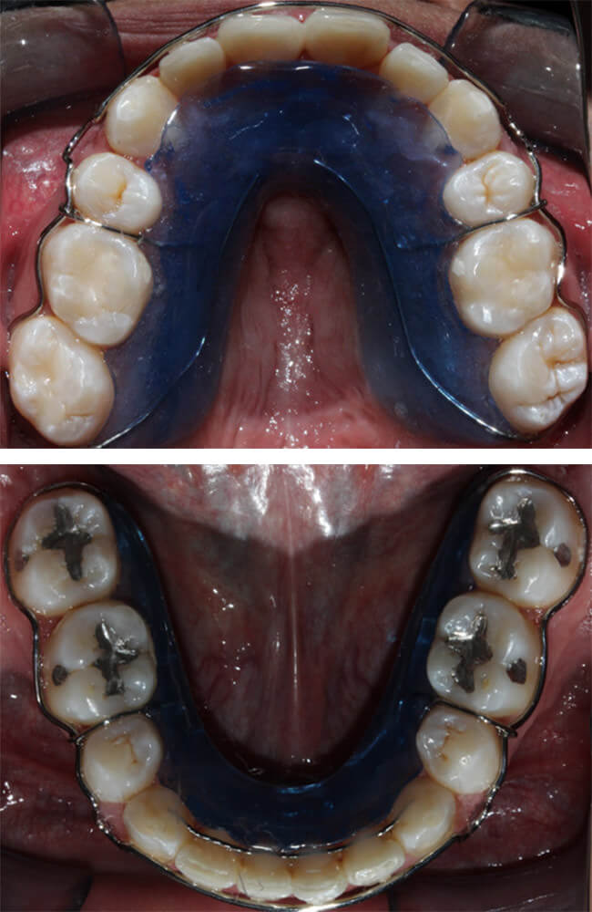 Fig. 22 Circunferenciales 