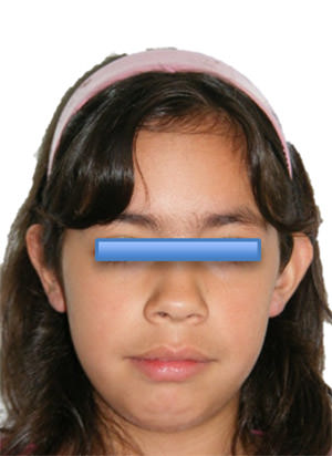 Fig. 1 Inicial de frente