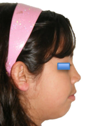 Fig. 2 Inicial de perfil