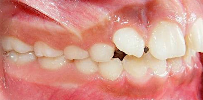 Fig. 5 Intraoral derecha