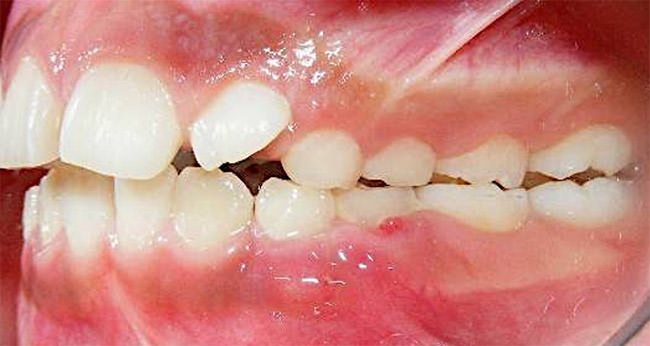 Fig. 6 Izquierda