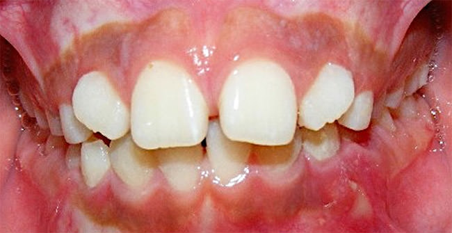 Fig. 7 Frente
