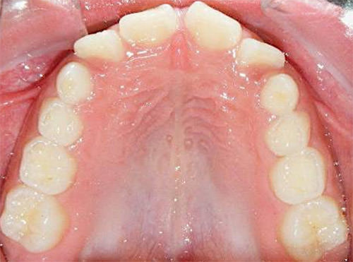Fig. 8 Oclusal superior
