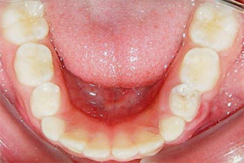 Fig. 9 Oclusal inferior
