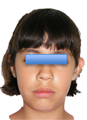 Fig. 10 Frente progreso I